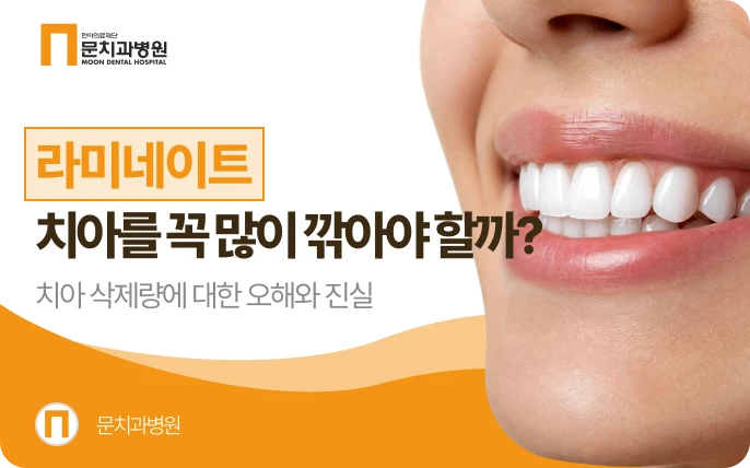라미네이트, 치아를 꼭 많이 깎아야 할까