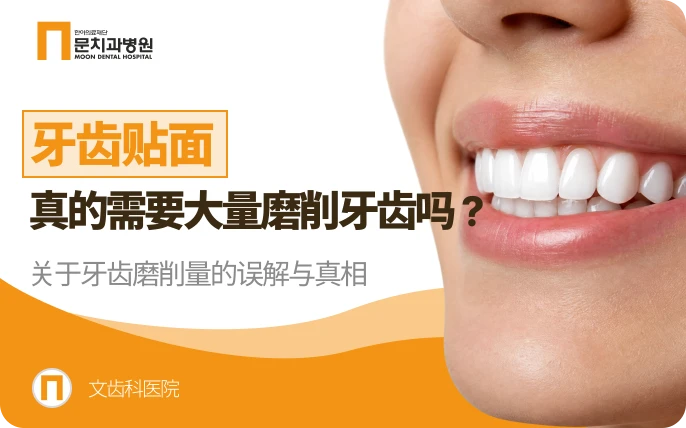 层叠术, 牙齿一定要磨掉那么多吗？